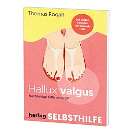 Hallux valgus